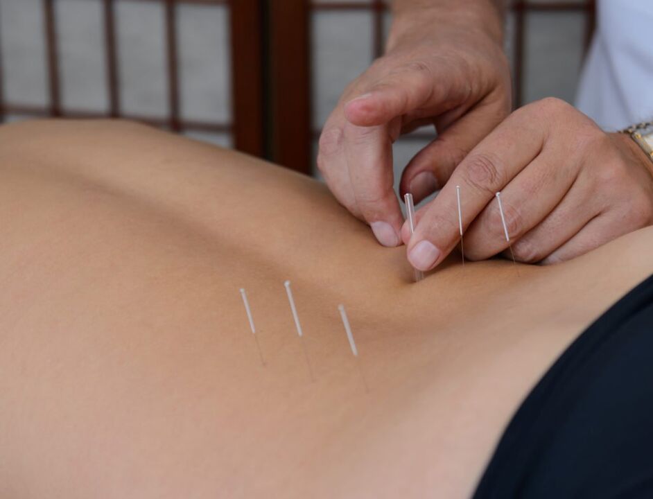 acupuncture para sa prostatitis