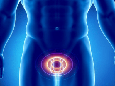 Prostatitis – pamamaga ng prostate gland sa isang lalaki
