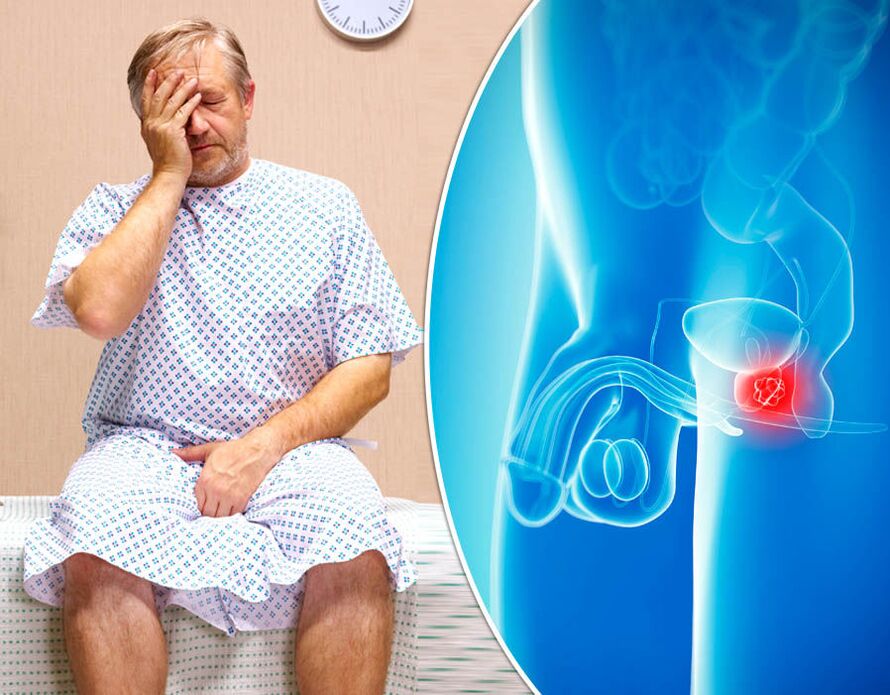 Isang lalaking may prostatitis ay nasusuring may sakit
